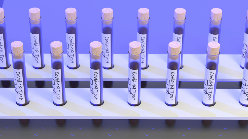 پسزمینه آزمایشگاه